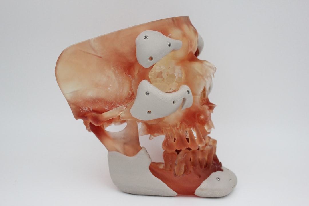 3D printed skull model with implant features